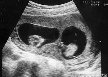 如果我怀了我儿子的孩子怎么办DNA检测结果显示孩子父亲另有其人 如果我怀了我儿子的孩子怎么办DNA检测结果显示孩子父亲另有其人